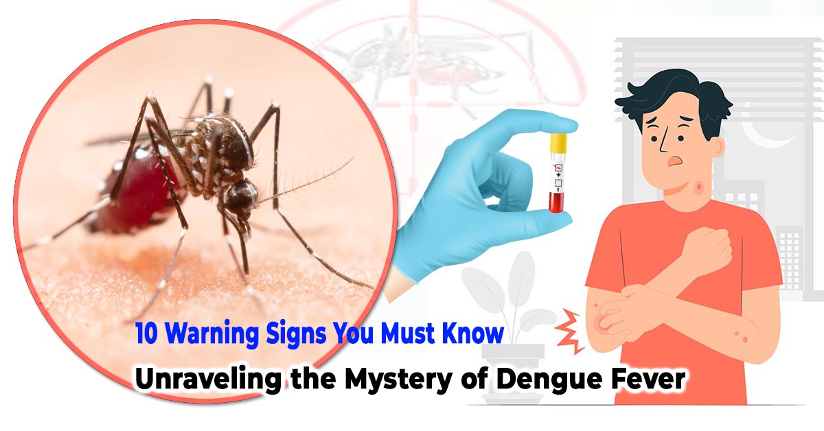 Unraveling the Mystery of Dengue Fever: 10 Warning Signs You Must Know