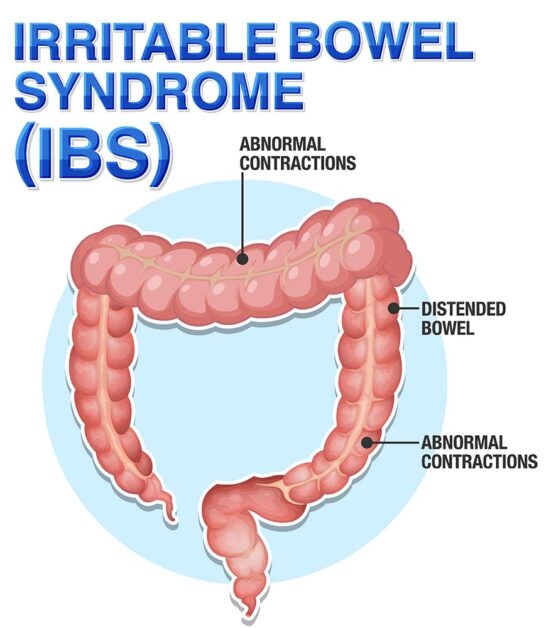 Fiber-Rich Diet to Help Manage IBS Symptoms