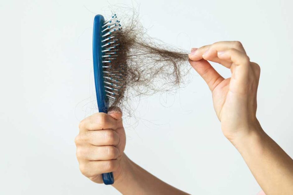 Hair Shedding