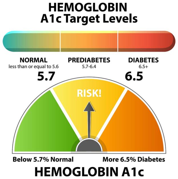 Hemoglobin A1c levels indicating normal, prediabetes, and diabetes risk.