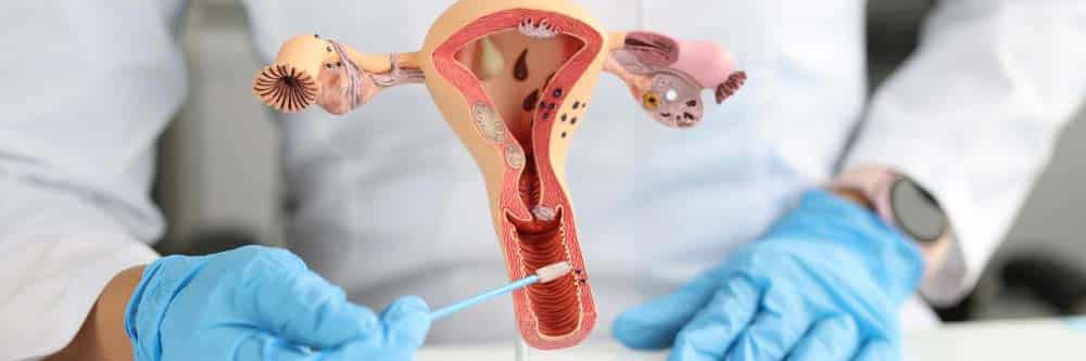 Close-up of doctor using cervix model to explain Pap smear screening for cervical cancer detection.