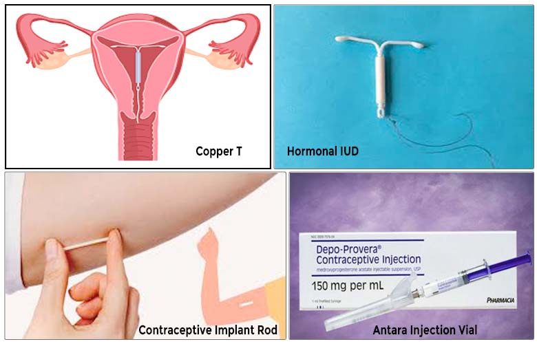 Images of IUDs, implant rod, and contraceptive injection methods