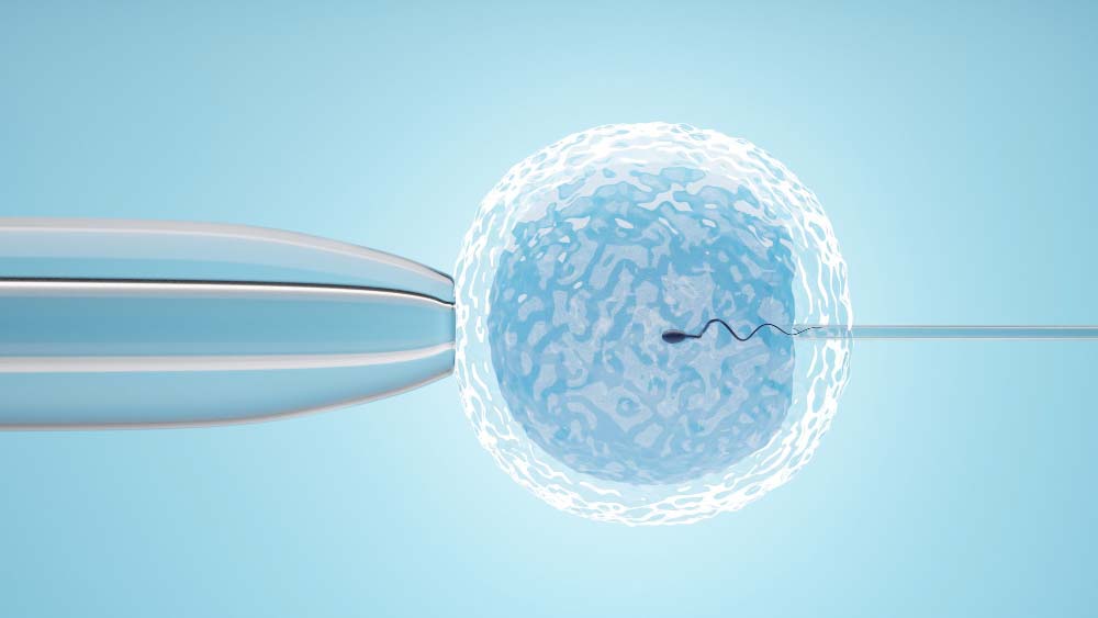 Laboratory fertilization step in in vitro fertilization treatment